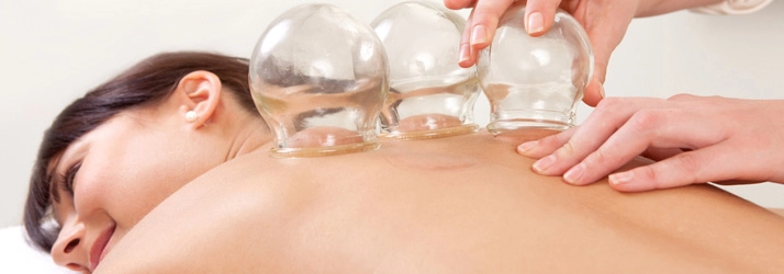 Chiropractic Matthews NC Cupping On Back